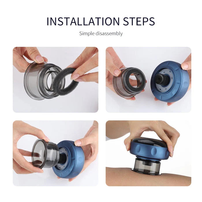 Smart Cupping Therapy Massager